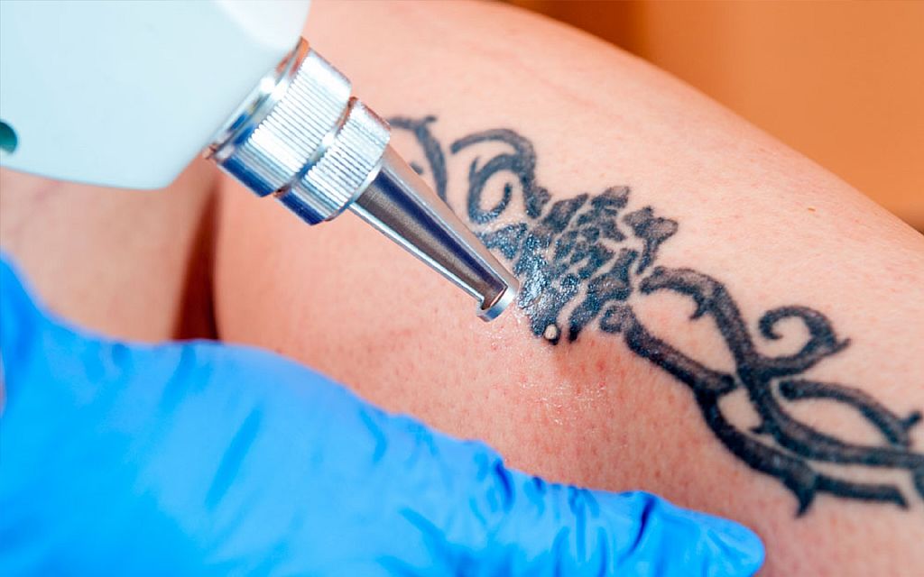 Учёные теперь могут набивать тату с помощью лазера