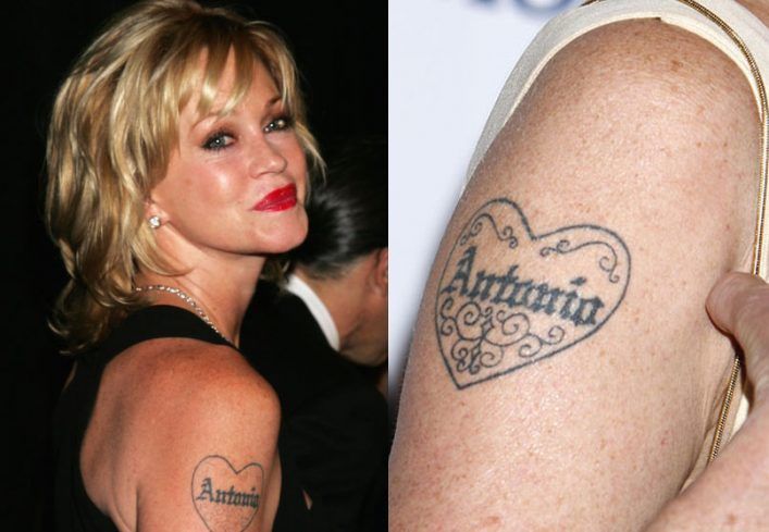 массового выводят татуировки